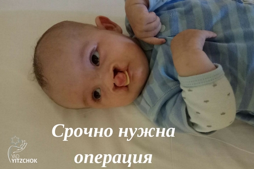 Срочная операция для 4 месячного ребенка